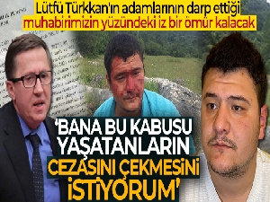 Lütfü Türkkan'ın adamlarının darp ettiği muhabirimizin yüzündeki iz bir ömür kalacak