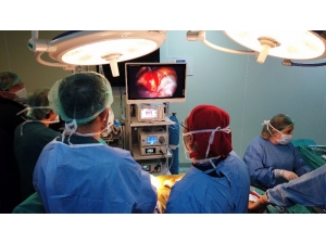 Endoskopik Kalp Operasyonu Türkiye’de İlk Kez Sakarya’da Gerçekleştirildi