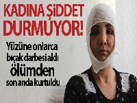 Kocası yüzünü bıçakla paramparça etti, ölümden kıl payı kurtuldu