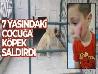 Bursa'da köpeğin saldırdığı çocuk yaralandı