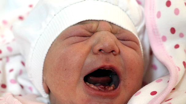 Amasya'da Dokuz Dişli Bebek Dünyaya Geldi