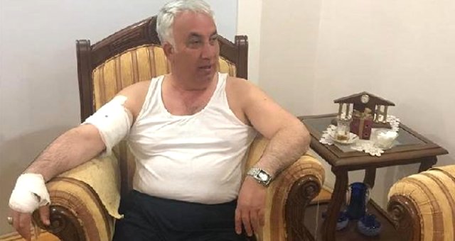 Arpaçay Belediye Başkanı, Köpek Saldırısında Yaralandı: Beni Parçalamaya Çalıştı