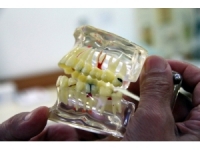 Diş Hekimlerinde İşler Yüzde 50’den Fazla Düştü