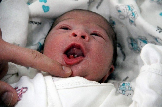 Miraç Bebek İki Dişli Dünyaya Geldi