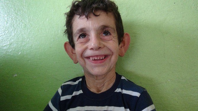 Suriyeli Mehmet'in Dramı Yürek Burkuyor