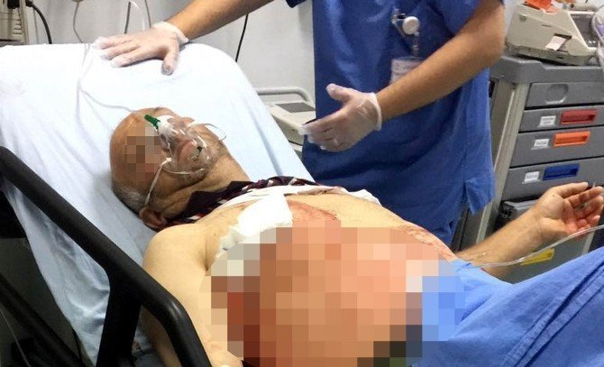 Samsun'da 46 Yaşındaki Adam Bıçaklı Saldırıya Uğradı