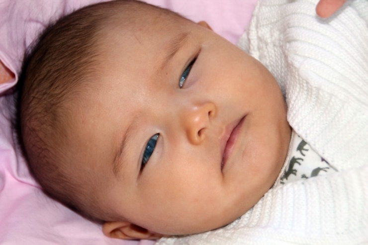 Masal Bebek Kornea Nakli Yapılmazsa Karanlıkta Kalacak