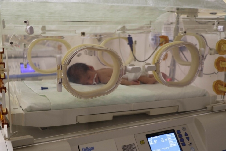 Prematüre Bebeklerde Yaşama Tutunma Şansı Yüzde 80’nin Üzerine Çıktı