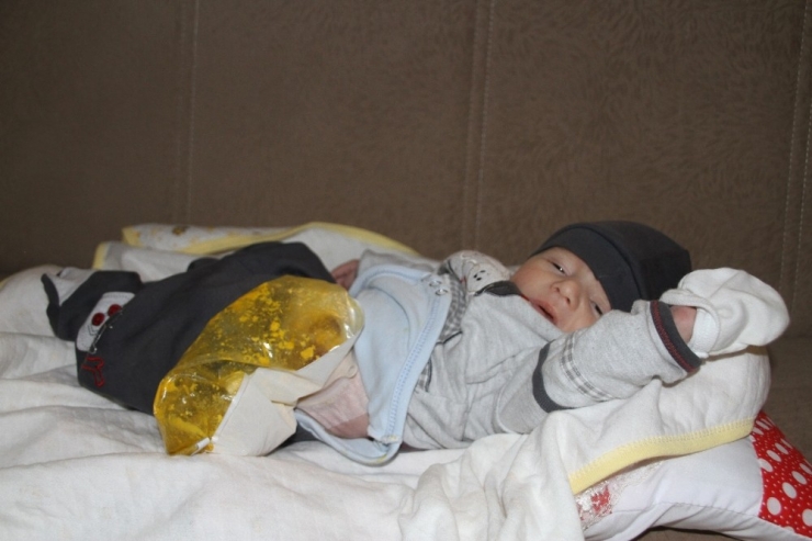 Eve Gönderilen Bebeğin Makatının Kapalı Olduğu 3 Gün Sonra Fark Edildi