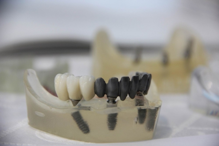Diş Hekimlerinde İşler Yüzde 50’den Fazla Düştü
