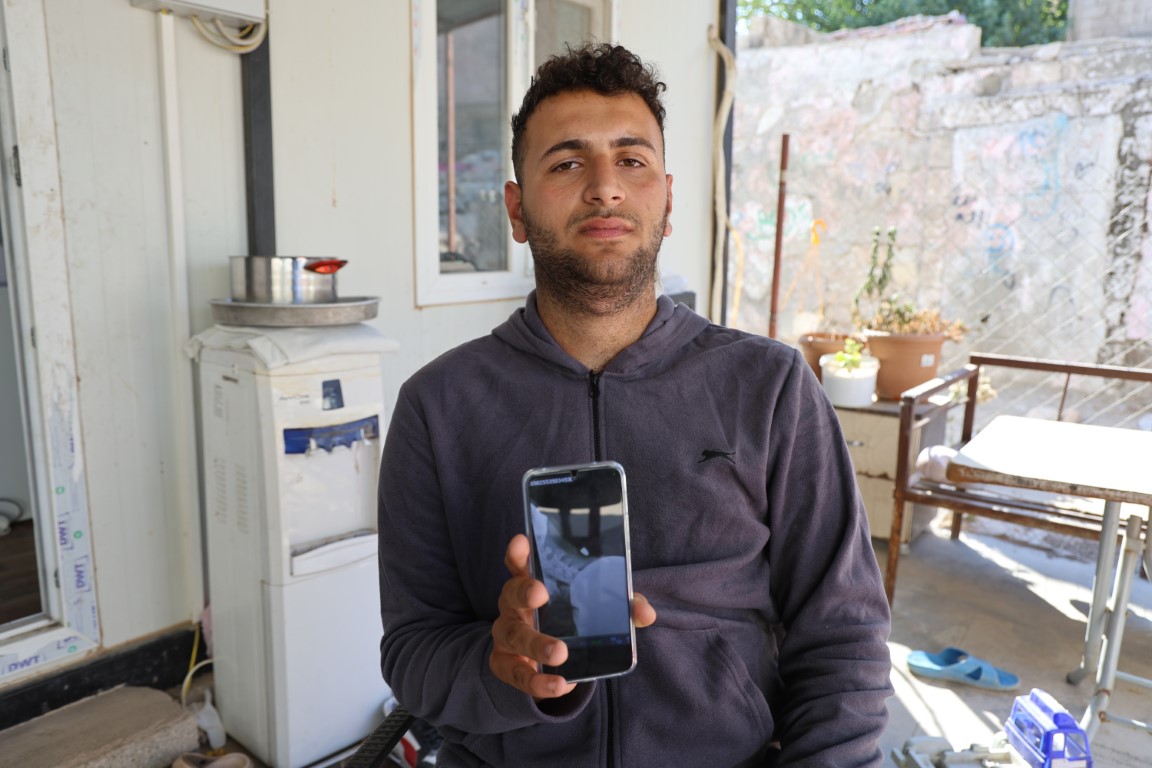 Ensesine yorgun mermi isabet eden 18 yaşındaki genç, 2 santimle ölümden döndü