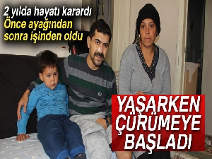 Yaşarken çürümeye başladı