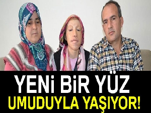 Yeni bir yüz umuduyla yaşıyor!