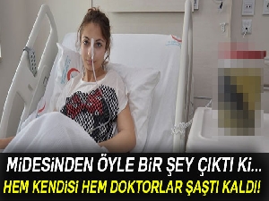 Midesinden 1.5 kilogram ağırlığında saç yumağı çıktı