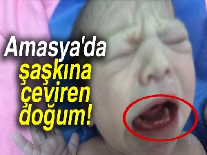 Amasya'da şaşkına çeviren doğum!