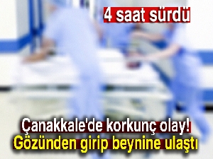 Çanakkale'de korkunç olay! Gözünden girip beynine ulaştı