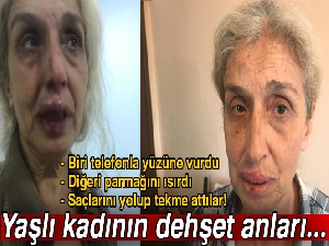 Sokak hayvanlarını beslerken başka kadınların saldırısına uğradı