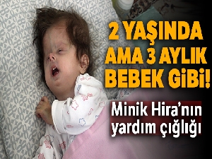2 yaşında ama 3 aylık bebek gibi