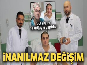 İki fotoğraf arasında inanılmaz fark