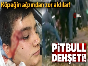 Pitbull'un saldırdığı çocuğu, köpeğin ağzından zor aldılar