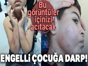 Uşak'ta engelli çocuğa darp iddiası