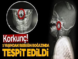 1 yaşındaki bebeğin boğazına mandal yayı saplandı
