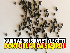Genç kadının safra kesesinden 200 tane taş çıktı