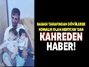 Babası tarafından dövülerek komalık olan Mertcan hayata tutunamadı