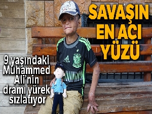 Savaşın en acı yüzü Suriyeli Muhammed