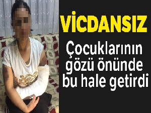 Kocası inşaat demiriyle döverek bu hale getirdi