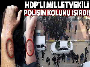 HDP'li vekil polis memurunun kolunu ısırdı