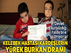 Kelebek hastası kardeşlerin yürek burkan dramı