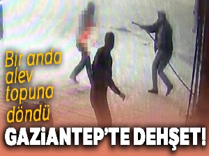 Alev alev yanan adam hortumla söndürüldü