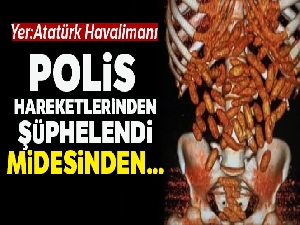 Midesinden 1 kilo uyuşturucu çıktı