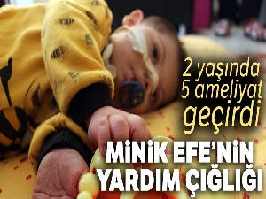 Down sendromlu minik Efe sağlığına kavuşacağı günü bekliyor