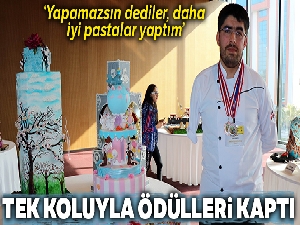 Tek koluyla sanat eseri pastalar yaptı