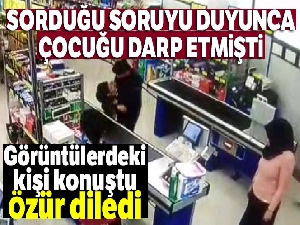 Çocuğun darp iddiasında, kadın özür diledi