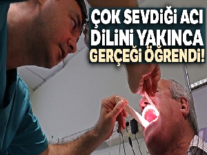 Çok sevdiği acı, dilini yakınca kanser olduğunu öğrendi