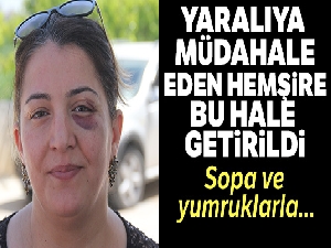 Yaralıya müdahale eden hemşire bu hale getirildi