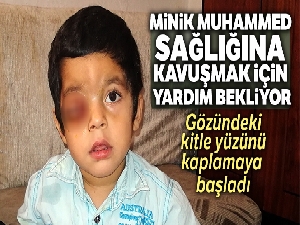 Gözündeki kitle giderek büyüyen Suriyeli Muhammed tedavi için yardım bekliyor