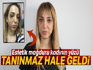 Estetik mağduru kadının yüzü tanınmaz hale geldi