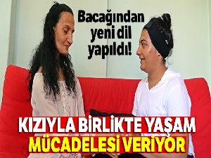 Bacağından yeni dil yapıldı! |Kızıyla birlikte yaşam mücadelesi veriyor