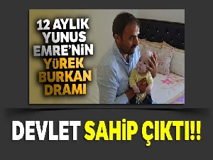 Beyninin bir kısmı dışarıda olan bebeğe devlet sahip çıktı