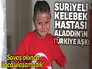 Suriyeli 'kelebek' hastası Aladdin'in Türkiye aşkı