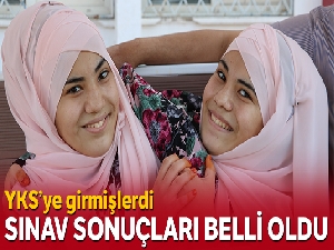 Siyam ikizleri tercih yapamadı