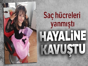 Saç hücreleri yanan Zeynep, hayalini kurduğu peruğa kavuştu