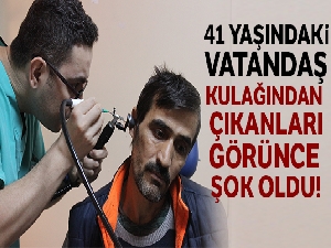 Kaşınıyor dediği kulağından sinek larvaları çıktı