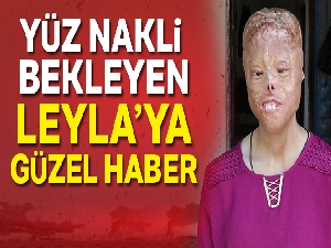 Sağlık Bakanlığı yüz nakli bekleyen Leyla için harekete geçti