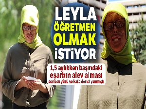 Yüz nakli heyecanı saran Leyla öğretmen olmak istiyor