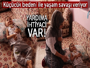 Küçücük bedeni ile yaşam savaşı veriyor